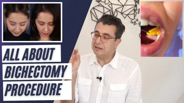Dr. Göksel explaining the bichectomy procedure and aesthetic benefits.